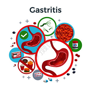 伊皮尔胃炎疾病症状导致药物扁平圆形成健康受影响的胃细菌食物矢量插图插画
