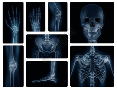 颅骨骨盆胸部膝盖四肢的真实X线照片人体骨骼真实的拍摄插画