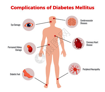 损害赔偿糖尿病并发症医学教育图表海报与受影响的人体器官损害描述描述平矢量插图插画
