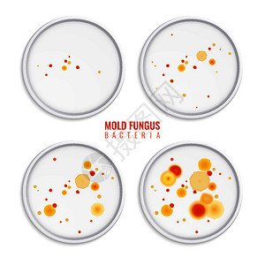 霉菌细菌菌落集四个真实的图像与圆形框架,彩色点文本矢量插图图片