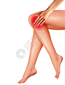 女腿疼痛与膝关节疼痛符号矢量现实插图女腿疼痛的现实插图插画