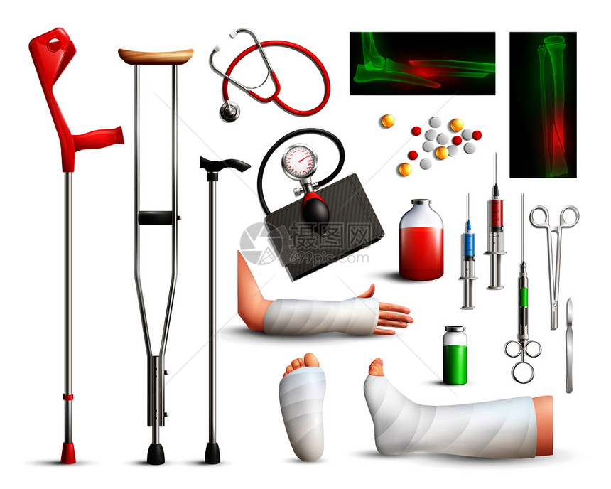 创伤手术现实与X线片,贴着四肢,拐杖,手术工具白色背景上矢量插图创伤手术现实图片