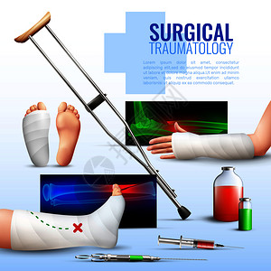 x型腿外科创伤学的现实与手足腿部损伤符号矢量插图外科创伤学的插画