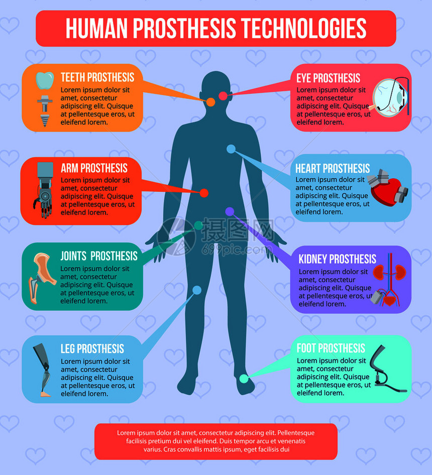 人类医学原型现代技术平信息画海报与集成植入机器人手臂人工关节矢量插图人类原型技术信息图片