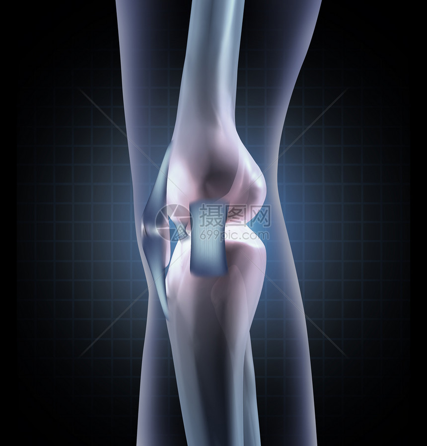 医学概念是人腿关节的侧面带和长颈作为运动医学受伤或诊断的整形象征图片