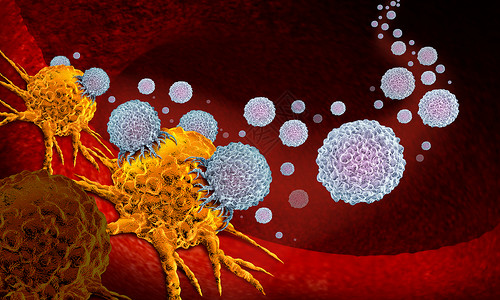 鳞状细胞癌作为肿瘤治疗和疾病概念的肿瘤癌疫苗以人体细胞的免疫疗法作为3个插图背景