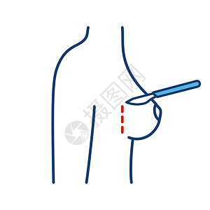 切口22胸外切开颜色图标矫正女乳房手术透开整形手术外皮切开孤立的病媒图例胸外切开开外插画