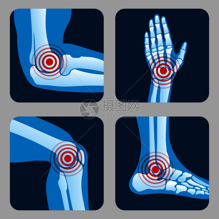 与止痛环关节炎和风湿病相关的人类节炎和风湿病感应医疗用程序矢量按钮关骨膝腿和手插图中的疾病与止痛环的人类关节医疗应用程序矢量按钮图片