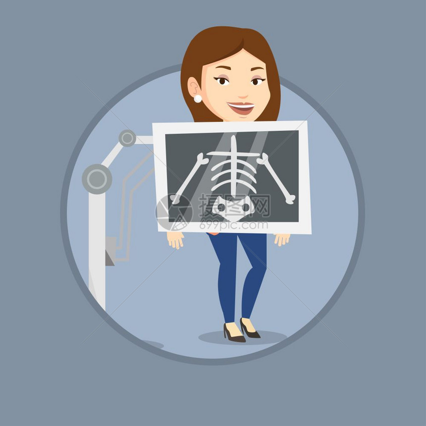 做胸部X射线检查的女青年卡通矢量插画图片