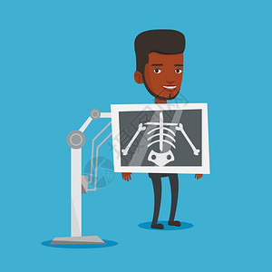 检查胸部x射线的非洲男青年卡通矢量插画图片