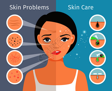 皮肤瑕疵皮肤清洁油护理和美容学皮肤有问题女头部矢量图插画