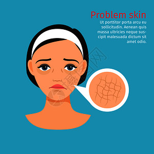 皱纹治疗妇女面临干皮肤问题矢量说明妇女面临干皮肤问题插画