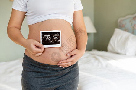 孕妇产前肚子图片