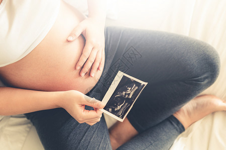 孕妇手里拿着四维照片背景