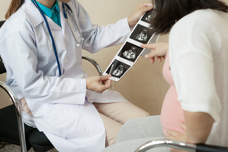 孕期检查图片