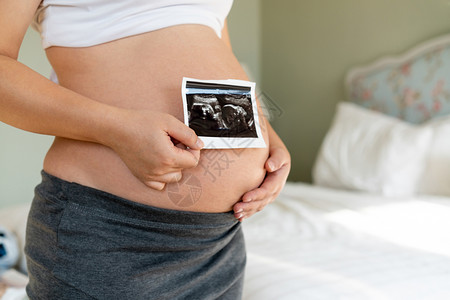 孕妇产前状态图片