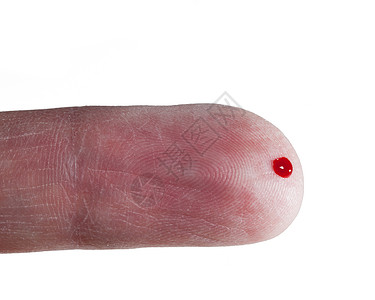 老人手指上的血滴图片
