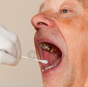唾液采集手套从男高年长者身上采集体液样本进行DNA检测背景