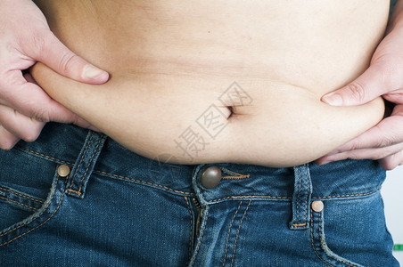 女人从腹部抽取脂肪闭紧镜头图片