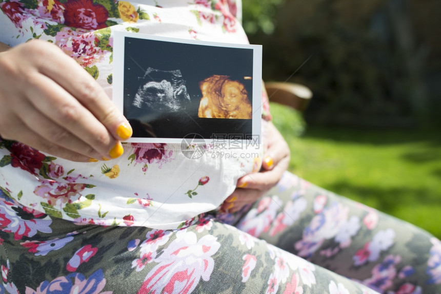 孕妇在花园展示彩超照片图片