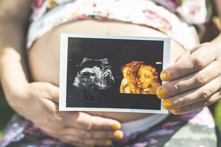 孕妇有子宫的照片在花园图片