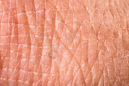 宏观拍摄人类皮肤的纹理图片