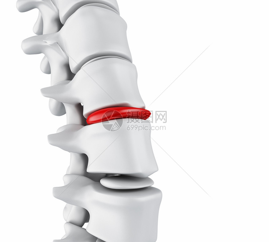 3d插图骨骼结构和间脊椎盘的闭合嵌入磁盘概念图片
