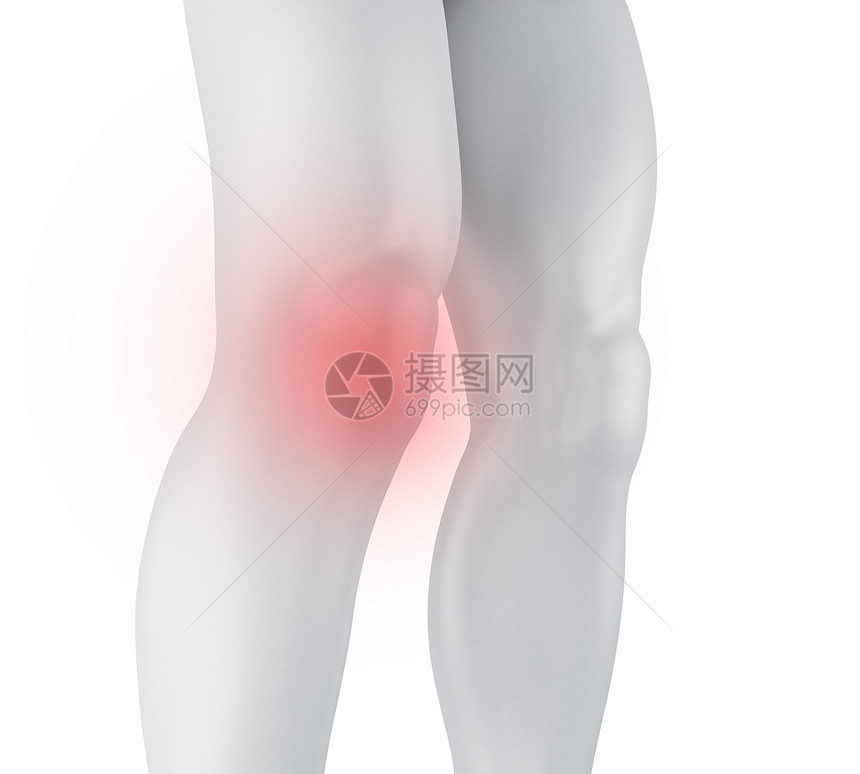 3个插图膝盖痛医学概念孤立的白种背景图片