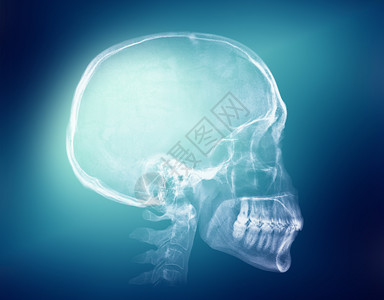 蓝背景的人类头骨X光图像图片