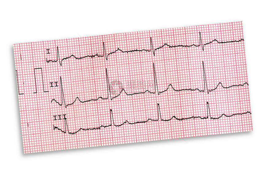 白色背景上孤立的心电图图片