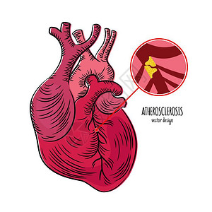 小动脉手绘医学教育图心脏插画