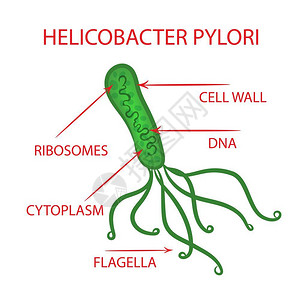 细胞质幽门螺杆菌病图解插画