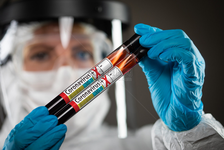 持有血管的女医生或护士血液测试管被贴上冠状cornaviuscovid19疾病阳标签图片