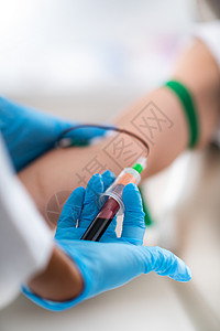 pr治疗为血浆丰富的小板上注入抽血为减少面皱纹而进行美学医治疗或血浆丰富的治疗抽背景图片