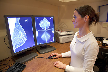 放射技术员检查乳腺造影测试图片