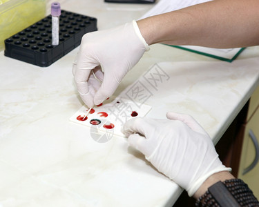 验血设备图片