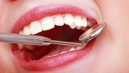 牙科护理缝合的年轻女接受牙齿检查健康的女牙齿和医口镜图片