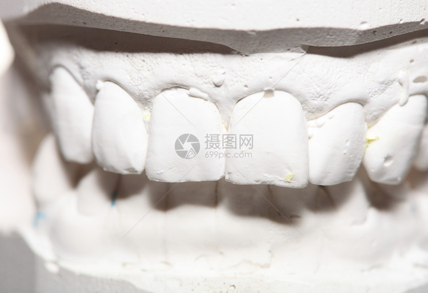 石膏模型人类下巴形态学假牙试验室技术图片