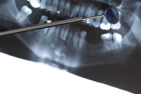 电影分镜人体牙齿和镜全景X光图像扫描背景