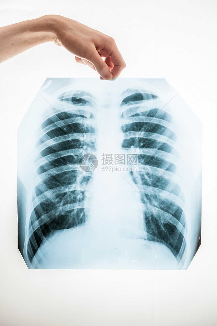 近距离拍摄男子持有肺X光片白色背景图片