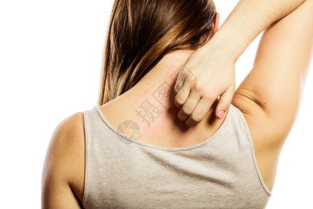 年轻女人用白的过敏皮疹抓着痒的背部图片