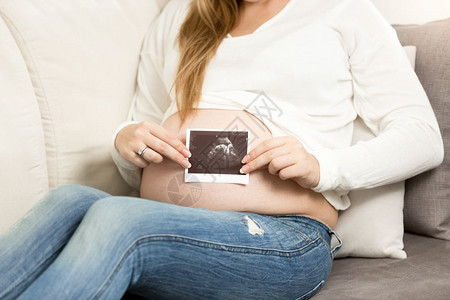 孕妇拍摄超声波扫描的近视照片图片