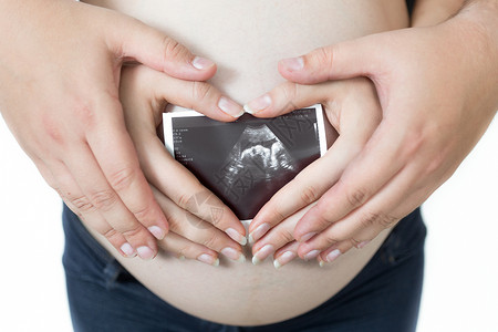 孕妇和丈夫的超声波胎儿图像图片
