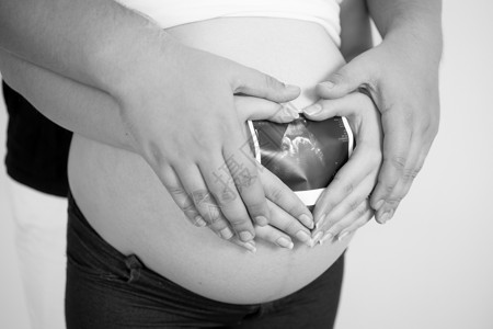 年轻夫妇怀孕婴儿的黑白概念照片图片