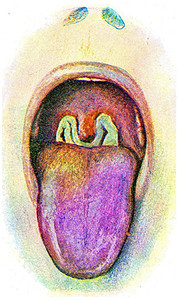 白喉刻有古代文字的插图图片