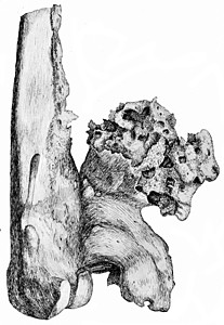 在股骨下端的阴蒂方面有骨灰素刻古老的画图片