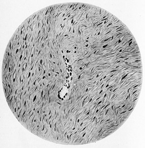 软纤维瘤旧式刻字插图图片