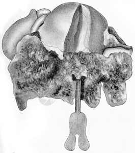 子宫颈细胞的缩影刻有老式的图图片