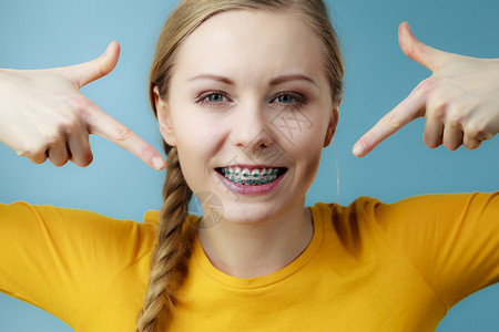 年轻女少笑着用手指牙套的穿着蓝衣服年轻女显示牙套图片