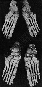 人右脚和左的骨骼刻着古老的图解来自宇宙和人类190年背景